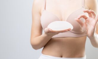 Lifting prsníkov s implantátmi (augmentačná mastopexia)