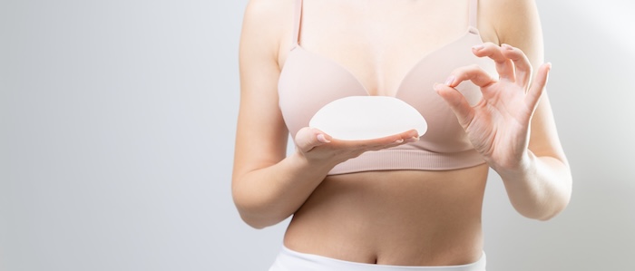 Lifting prsníkov s implantátmi (augmentačná mastopexia)