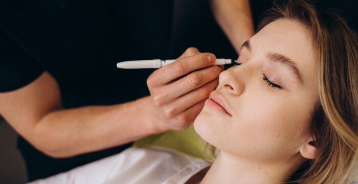 blefaroplastika operácia očných viečok