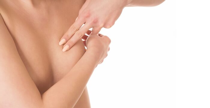 odstránenie jaziev na prsiach po mastopexii