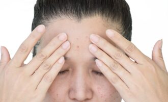 cievny angiom odstranenie